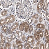 Anti-YBEY antibody produced in rabbit Prestige Antibodies® Powered by Atlas Antibodies, affinity isolated antibody, buffered aqueous glycerol solution, Ab2