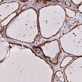 Anti-CHMP1B antibody produced in rabbit Prestige Antibodies&#174; Powered by Atlas Antibodies, affinity isolated antibody, buffered aqueous glycerol solution