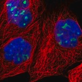 Anti-RRP1 antibody produced in rabbit Prestige Antibodies&#174; Powered by Atlas Antibodies, affinity isolated antibody, buffered aqueous glycerol solution, Ab1