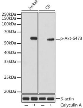 Anti-Phospho-Akt-S473 antibody produced in rabbit
