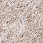Anti-ANXA6 antibody produced in rabbit Prestige Antibodies&#174; Powered by Atlas Antibodies, affinity isolated antibody, buffered aqueous glycerol solution
