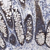 Anti-TBRG4 antibody produced in rabbit Prestige Antibodies&#174; Powered by Atlas Antibodies, affinity isolated antibody, buffered aqueous glycerol solution