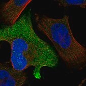 Anti-ZNF582 antibody produced in rabbit Prestige Antibodies® Powered by Atlas Antibodies, affinity isolated antibody, buffered aqueous glycerol solution