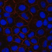 Anti-EGFR Antibody, clone 7F12.1 clone 7F12.1, from mouse