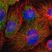 Anti-ANXA4 antibody produced in rabbit Prestige Antibodies&#174; Powered by Atlas Antibodies, affinity isolated antibody, buffered aqueous glycerol solution