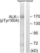 Anti-ALK (Phospho-TYR1604) affinity isolated antibody