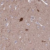 Anti-CEP41 antibody produced in rabbit Prestige Antibodies&#174; Powered by Atlas Antibodies, affinity isolated antibody, buffered aqueous glycerol solution