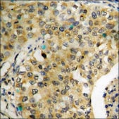 Anti-phospho-NF-kappaB p65 (pSer276) antibody produced in rabbit affinity isolated antibody