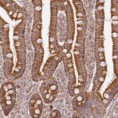 Anti-CNOT1 antibody produced in rabbit Prestige Antibodies&#174; Powered by Atlas Antibodies, affinity isolated antibody, buffered aqueous glycerol solution