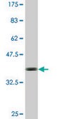 Monoclonal Anti-CCDC5, (C-terminal) antibody produced in mouse clone 1E3, purified immunoglobulin, buffered aqueous solution