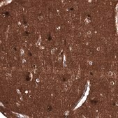 Monoclonal Anti-ID1 antibody produced in mouse Prestige Antibodies® Powered by Atlas Antibodies, clone CL11981, purified immunoglobulin, buffered aqueous glycerol solution