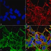 Monoclonal Anti-Alpha 2C Adrenergic Receptor - Biotin antibody produced in mouse clone S330A-80, purified immunoglobulin