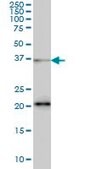 Monoclonal Anti-FUSIP1 antibody produced in mouse clone 1A6, purified immunoglobulin, buffered aqueous solution