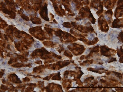 Monoclonal Anti-SPINK1 antibody produced in mouse clone 4D4, purified immunoglobulin, buffered aqueous solution
