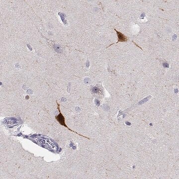 Anti-YJEFN3 antibody produced in rabbit Prestige Antibodies&#174; Powered by Atlas Antibodies, affinity isolated antibody, buffered aqueous glycerol solution