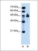 Anti-IHH antibody produced in rabbit IgG fraction of antiserum