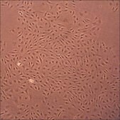 Porcine Pulmonary Artery Endothelial Cells: PPAEC (Cryovial)