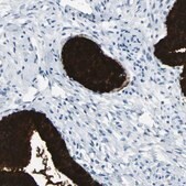 Anti-MUC5B antibody produced in rabbit Prestige Antibodies&#174; Powered by Atlas Antibodies, affinity isolated antibody, buffered aqueous glycerol solution
