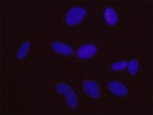 SMARCA4 and Estrogen Receptor Alpha PLA® Antibody Kit Powered by Bethyl Laboratories, Inc.