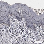 Anti-ACADM antibody produced in rabbit Prestige Antibodies&#174; Powered by Atlas Antibodies, affinity isolated antibody, buffered aqueous glycerol solution