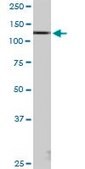 Anti-KIAA1967 antibody produced in mouse purified immunoglobulin, buffered aqueous solution