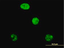 Anti-ADAR antibody produced in mouse purified immunoglobulin, buffered aqueous solution