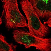 Anti-FAM219A antibody produced in rabbit Prestige Antibodies® Powered by Atlas Antibodies, affinity isolated antibody