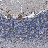 Anti-SLC25A25 antibody produced in rabbit Prestige Antibodies&#174; Powered by Atlas Antibodies, affinity isolated antibody, buffered aqueous glycerol solution