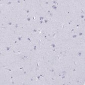 Anti-CD7 antibody produced in rabbit Prestige Antibodies® Powered by Atlas Antibodies, affinity isolated antibody, buffered aqueous glycerol solution