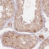 Monoclonal Anti-RHOT1 antibody produced in mouse Prestige Antibodies&#174; Powered by Atlas Antibodies, clone CL1083, purified immunoglobulin, buffered aqueous glycerol solution