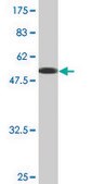 Monoclonal Anti-VAPA, (N-terminal) antibody produced in mouse clone 4C12, purified immunoglobulin, buffered aqueous solution