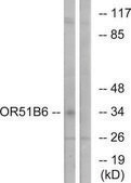 Anti-OR51B6 antibody produced in rabbit affinity isolated antibody