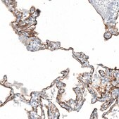 Monoclonal Anti-AGER antibody produced in mouse Prestige Antibodies® Powered by Atlas Antibodies, clone CL10587, purified antibody (Protein A)