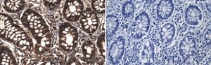 Anti- Galectin-3 Antibody, clone 1J2-H1 ZooMAb&#174; Rabbit Monoclonal recombinant, expressed in HEK 293 cells