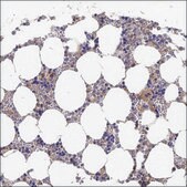 Anti-GNA15 antibody produced in rabbit Prestige Antibodies® Powered by Atlas Antibodies, affinity isolated antibody, buffered aqueous glycerol solution