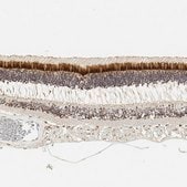 Anti-IMPG2 antibody produced in rabbit Prestige Antibodies&#174; Powered by Atlas Antibodies, affinity isolated antibody