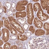 Anti-AHCY antibody produced in rabbit Prestige Antibodies&#174; Powered by Atlas Antibodies, affinity isolated antibody, buffered aqueous glycerol solution