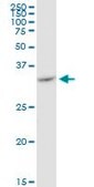 Monoclonal Anti-VDAC2 antibody produced in mouse clone 3D2, purified immunoglobulin, buffered aqueous solution