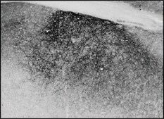 Anti-PENK antibody produced in goat affinity isolated antibody, buffered aqueous solution