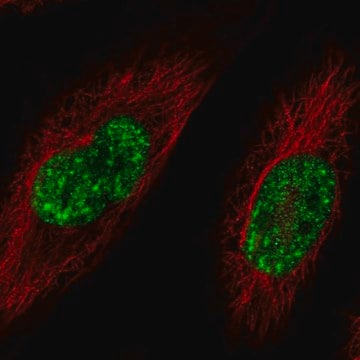 Anti-SREK1 antibody produced in rabbit Prestige Antibodies&#174; Powered by Atlas Antibodies, affinity isolated antibody