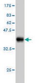 Monoclonal Anti-PDIA5 antibody produced in mouse clone 3A3, purified immunoglobulin, buffered aqueous solution
