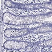 Anti-SLC9C2 antibody produced in rabbit Prestige Antibodies&#174; Powered by Atlas Antibodies, affinity isolated antibody, buffered aqueous glycerol solution