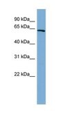 Anti-HNF1A, (N-terminal) antibody produced in rabbit affinity isolated antibody
