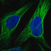 Anti-CCDC57 antibody produced in rabbit Prestige Antibodies&#174; Powered by Atlas Antibodies, affinity isolated antibody, buffered aqueous glycerol solution, Ab1