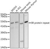 Anti-SR protein repeat Antibody, clone 2P4W4, Rabbit Monoclonal