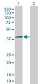 Anti-HSD3B2 antibody produced in rabbit purified immunoglobulin, buffered aqueous solution