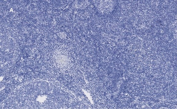Anti-Ki67 Antibody, clone 1O15, ZooMAb&#174; Rabbit Monoclonal recombinant, expressed in HEK 293 cells