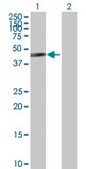 Anti-RP13-122B23.3 antibody produced in mouse purified immunoglobulin, buffered aqueous solution