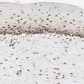 Anti-NR5A2 antibody produced in rabbit Ab1, Prestige Antibodies® Powered by Atlas Antibodies, affinity isolated antibody, buffered aqueous glycerol solution