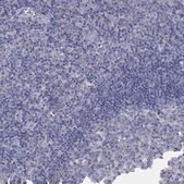 Anti-HEATR4 antibody produced in rabbit Prestige Antibodies&#174; Powered by Atlas Antibodies, affinity isolated antibody, buffered aqueous glycerol solution